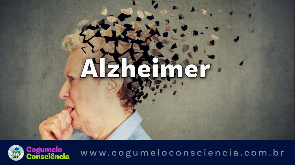 Alzheimer